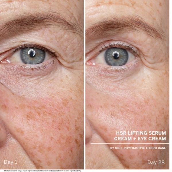Anti-wrinkle Eye Cream Cijena Akcija